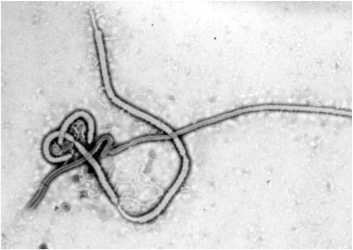 Liberia: Trường hợp đầu tiên bị nhiễm Ebola qua đường tình dục
