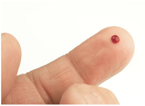 Chẩn đoán ung thư sớm nhờ RNA trong máu