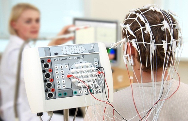 Ứng dụng của điện não đồ (EEG) trong dự đoán cơn động kinh