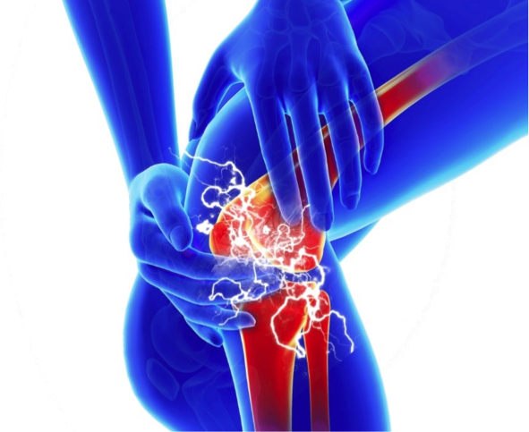 Thoái hóa khớp gối: Hướng điều trị